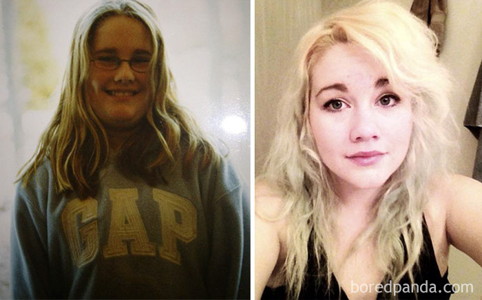 People Share Their Incredible “Ugly Duckling” Transformations And It’s Hard To Believe They’re The Same People People Share Their Incredible “Ugly Duckling” Transformations And It’s Hard To Believe They’re The Same People