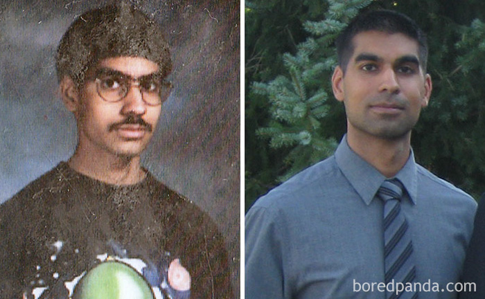 People Share Their Incredible “Ugly Duckling” Transformations And It’s Hard To Believe They’re The Same People People Share Their Incredible “Ugly Duckling” Transformations And It’s Hard To Believe They’re The Same People