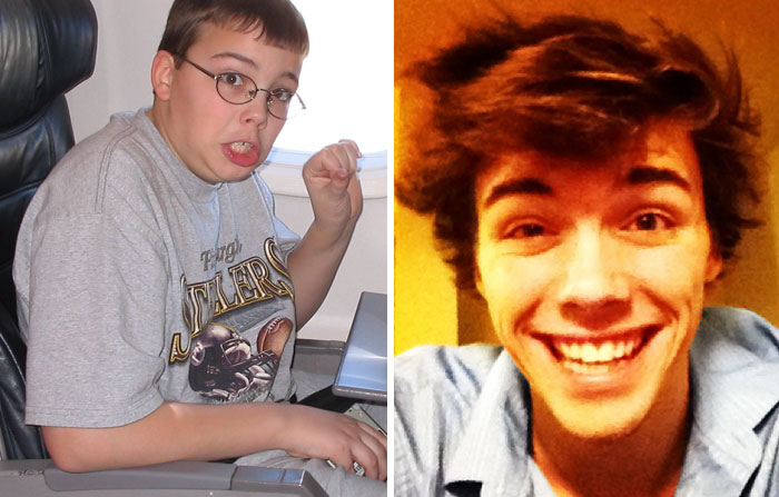 People Share Their Incredible “Ugly Duckling” Transformations And It’s Hard To Believe They’re The Same People People Share Their Incredible “Ugly Duckling” Transformations And It’s Hard To Believe They’re The Same People