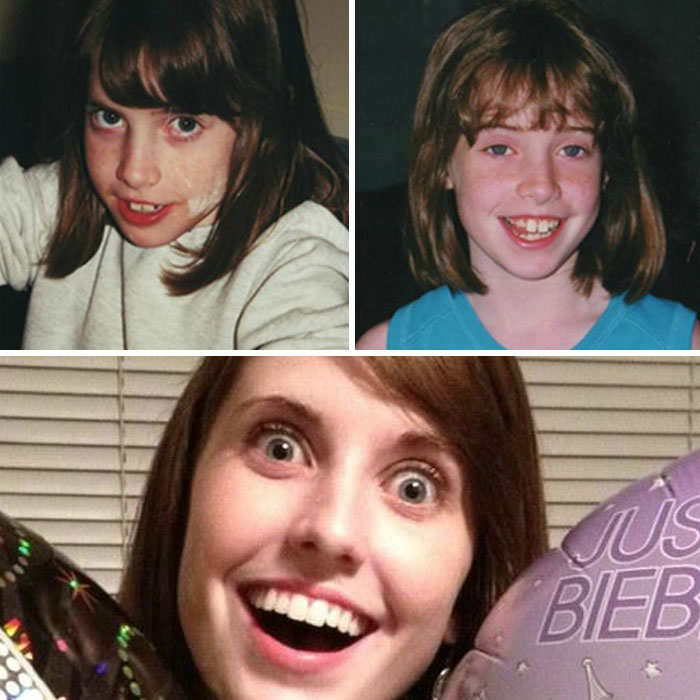 People Share Their Incredible “Ugly Duckling” Transformations And It’s Hard To Believe They’re The Same People People Share Their Incredible “Ugly Duckling” Transformations And It’s Hard To Believe They’re The Same People