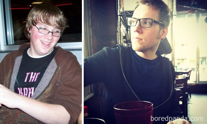 People Share Their Incredible “Ugly Duckling” Transformations And It’s Hard To Believe They’re The Same People People Share Their Incredible “Ugly Duckling” Transformations And It’s Hard To Believe They’re The Same People