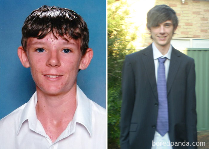 People Share Their Incredible “Ugly Duckling” Transformations And It’s Hard To Believe They’re The Same People People Share Their Incredible “Ugly Duckling” Transformations And It’s Hard To Believe They’re The Same People