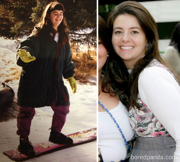 People Share Their Incredible “Ugly Duckling” Transformations And It’s Hard To Believe They’re The Same People People Share Their Incredible “Ugly Duckling” Transformations And It’s Hard To Believe They’re The Same People