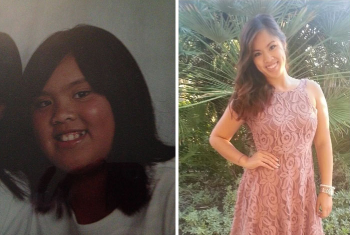 People Share Their Incredible “Ugly Duckling” Transformations And It’s Hard To Believe They’re The Same People People Share Their Incredible “Ugly Duckling” Transformations And It’s Hard To Believe They’re The Same People