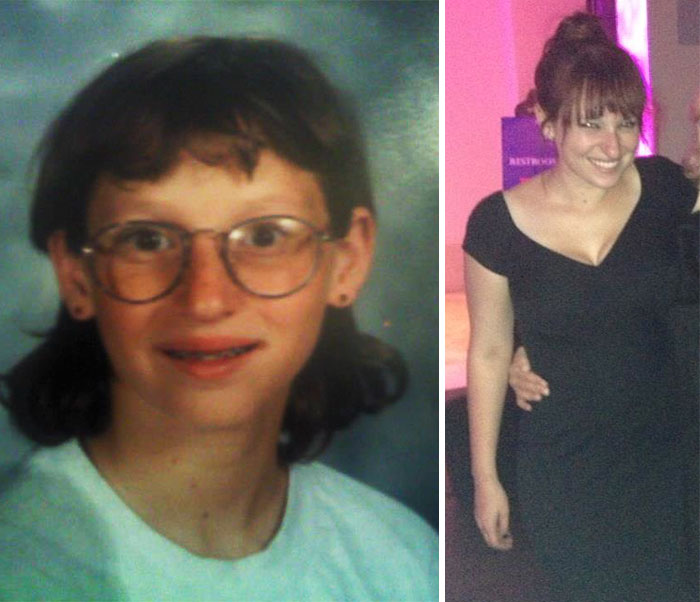 People Share Their Incredible “Ugly Duckling” Transformations And It’s Hard To Believe They’re The Same People People Share Their Incredible “Ugly Duckling” Transformations And It’s Hard To Believe They’re The Same People