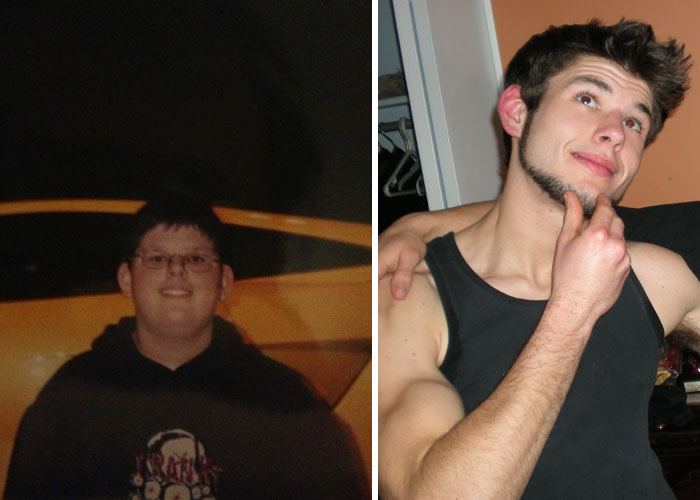 People Share Their Incredible “Ugly Duckling” Transformations And It’s Hard To Believe They’re The Same People People Share Their Incredible “Ugly Duckling” Transformations And It’s Hard To Believe They’re The Same People