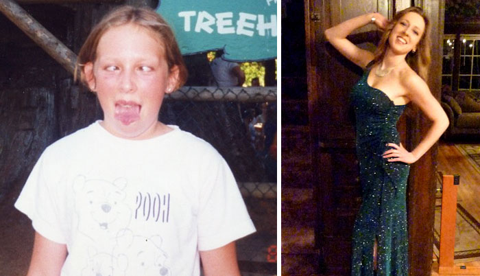 People Share Their Incredible “Ugly Duckling” Transformations And It’s Hard To Believe They’re The Same People People Share Their Incredible “Ugly Duckling” Transformations And It’s Hard To Believe They’re The Same People