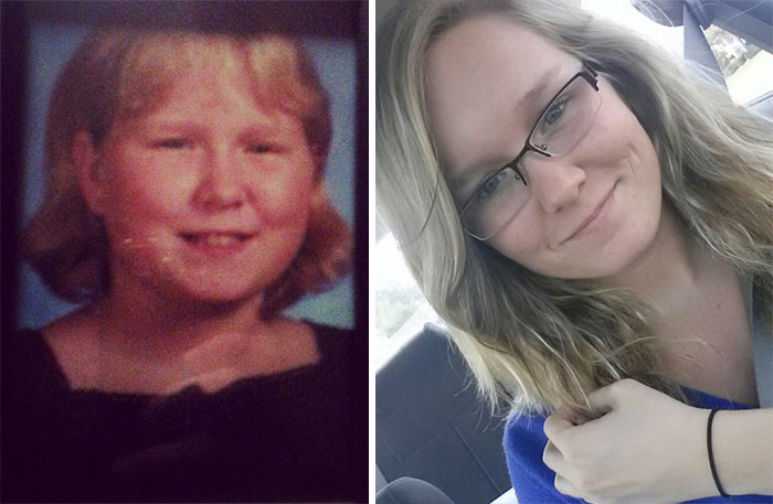 People Share Their Incredible “Ugly Duckling” Transformations And It’s Hard To Believe They’re The Same People People Share Their Incredible “Ugly Duckling” Transformations And It’s Hard To Believe They’re The Same People