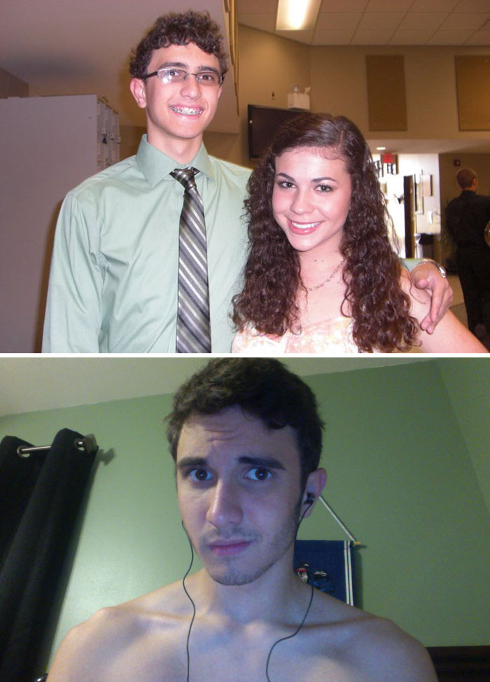 People Share Their Incredible “Ugly Duckling” Transformations And It’s Hard To Believe They’re The Same People People Share Their Incredible “Ugly Duckling” Transformations And It’s Hard To Believe They’re The Same People