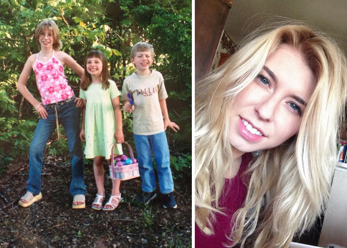 People Share Their Incredible “Ugly Duckling” Transformations And It’s Hard To Believe They’re The Same People People Share Their Incredible “Ugly Duckling” Transformations And It’s Hard To Believe They’re The Same People