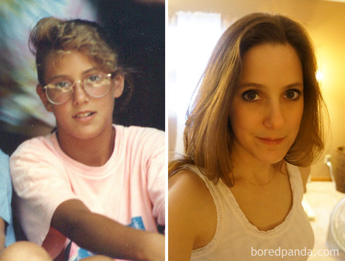 People Share Their Incredible “Ugly Duckling” Transformations And It’s Hard To Believe They’re The Same People People Share Their Incredible “Ugly Duckling” Transformations And It’s Hard To Believe They’re The Same People