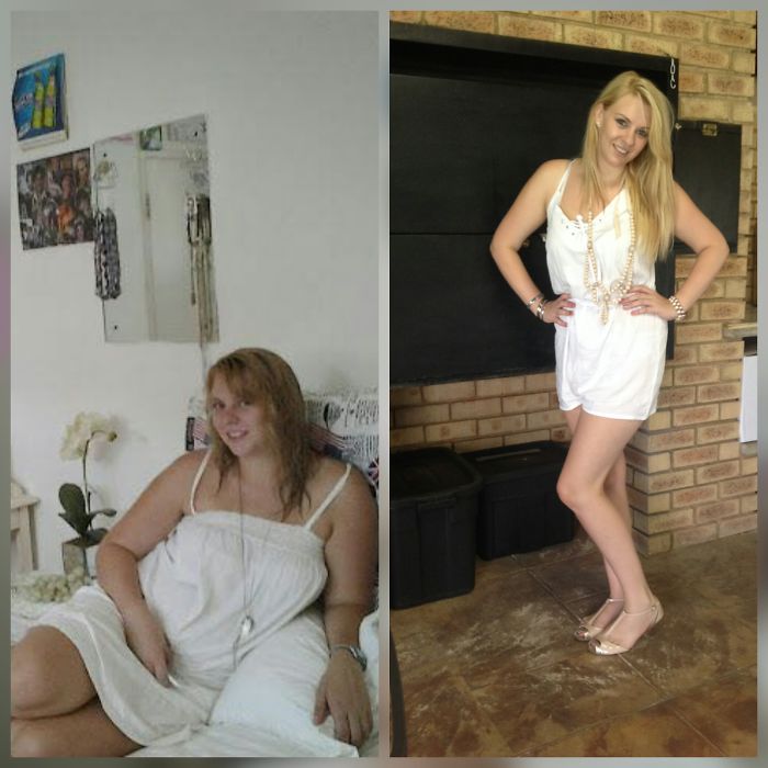 People Share Their Incredible “Ugly Duckling” Transformations And It’s Hard To Believe They’re The Same People People Share Their Incredible “Ugly Duckling” Transformations And It’s Hard To Believe They’re The Same People