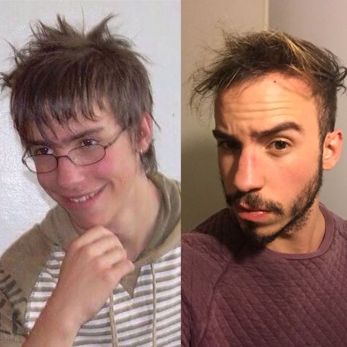 People Share Their Incredible “Ugly Duckling” Transformations And It’s Hard To Believe They’re The Same People People Share Their Incredible “Ugly Duckling” Transformations And It’s Hard To Believe They’re The Same People