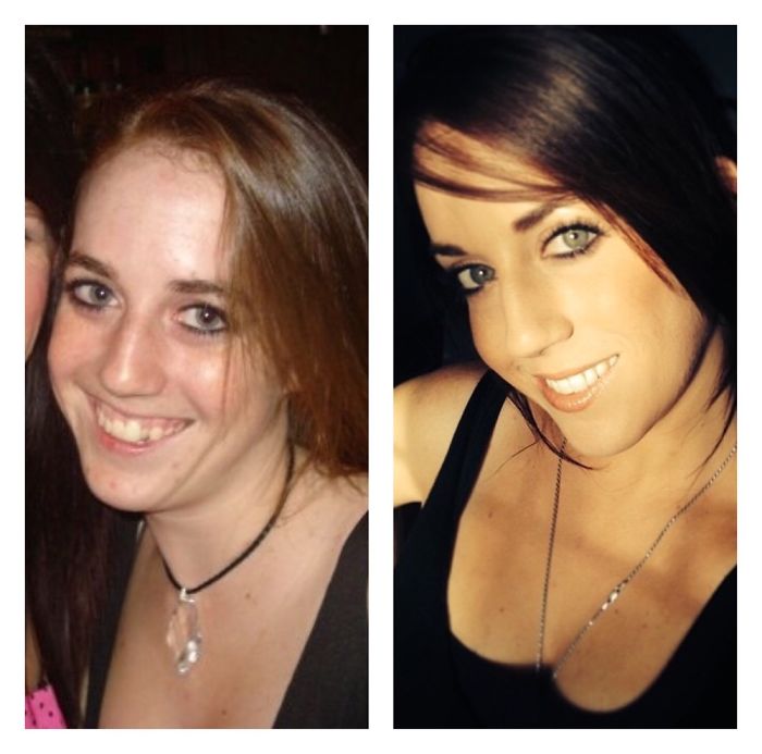 People Share Their Incredible “Ugly Duckling” Transformations And It’s Hard To Believe They’re The Same People People Share Their Incredible “Ugly Duckling” Transformations And It’s Hard To Believe They’re The Same People