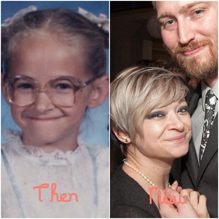 People Share Their Incredible “Ugly Duckling” Transformations And It’s Hard To Believe They’re The Same People People Share Their Incredible “Ugly Duckling” Transformations And It’s Hard To Believe They’re The Same People