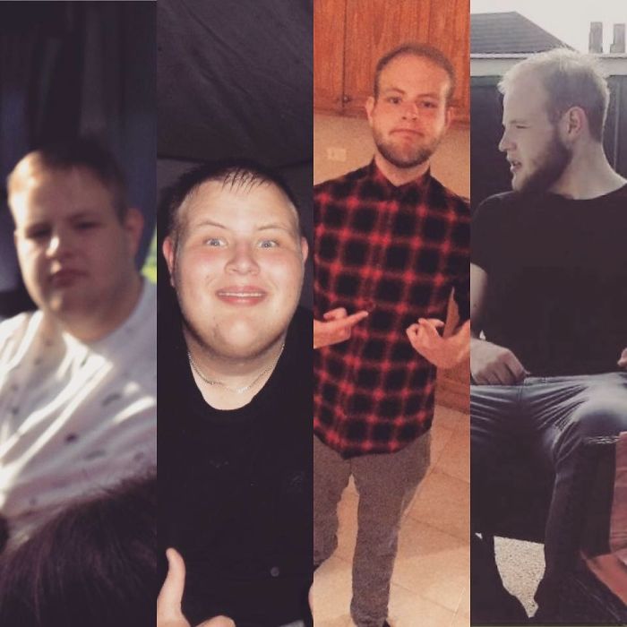 People Share Their Incredible “Ugly Duckling” Transformations And It’s Hard To Believe They’re The Same People People Share Their Incredible “Ugly Duckling” Transformations And It’s Hard To Believe They’re The Same People