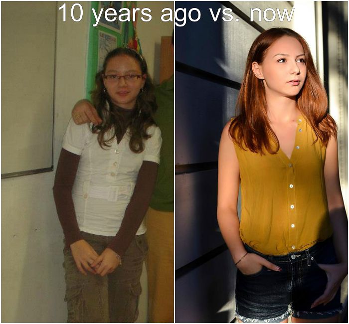 People Share Their Incredible “Ugly Duckling” Transformations And It’s Hard To Believe They’re The Same People People Share Their Incredible “Ugly Duckling” Transformations And It’s Hard To Believe They’re The Same People