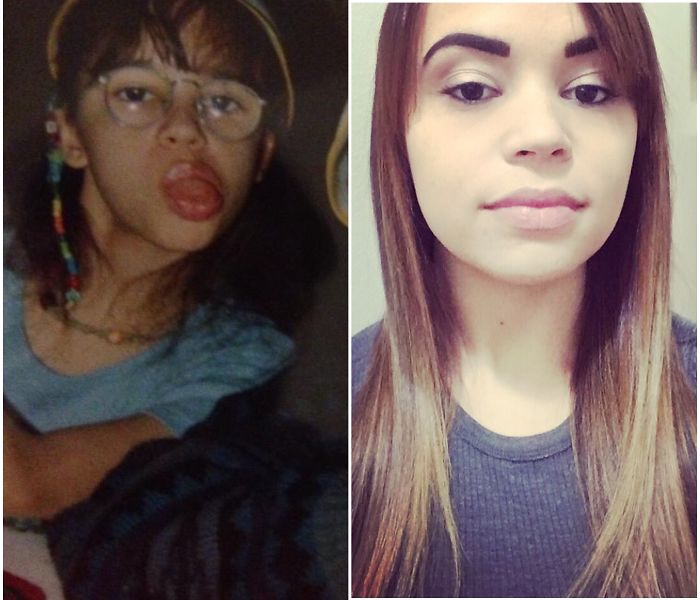 People Share Their Incredible “Ugly Duckling” Transformations And It’s Hard To Believe They’re The Same People People Share Their Incredible “Ugly Duckling” Transformations And It’s Hard To Believe They’re The Same People