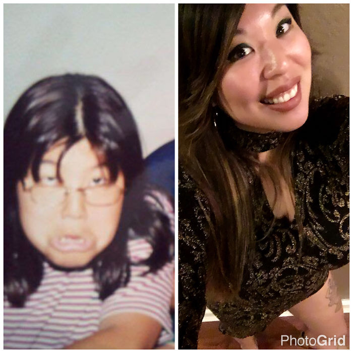 People Share Their Incredible “Ugly Duckling” Transformations And It’s Hard To Believe They’re The Same People People Share Their Incredible “Ugly Duckling” Transformations And It’s Hard To Believe They’re The Same People