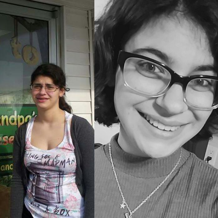 People Share Their Incredible “Ugly Duckling” Transformations And It’s Hard To Believe They’re The Same People People Share Their Incredible “Ugly Duckling” Transformations And It’s Hard To Believe They’re The Same People