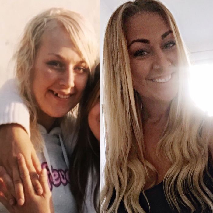 People Share Their Incredible “Ugly Duckling” Transformations And It’s Hard To Believe They’re The Same People People Share Their Incredible “Ugly Duckling” Transformations And It’s Hard To Believe They’re The Same People