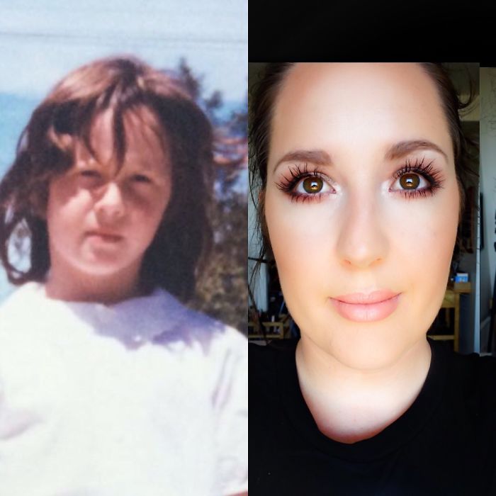 People Share Their Incredible “Ugly Duckling” Transformations And It’s Hard To Believe They’re The Same People People Share Their Incredible “Ugly Duckling” Transformations And It’s Hard To Believe They’re The Same People