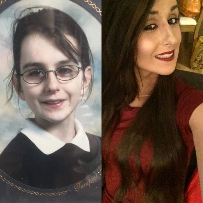 People Share Their Incredible “Ugly Duckling” Transformations And It’s Hard To Believe They’re The Same People People Share Their Incredible “Ugly Duckling” Transformations And It’s Hard To Believe They’re The Same People