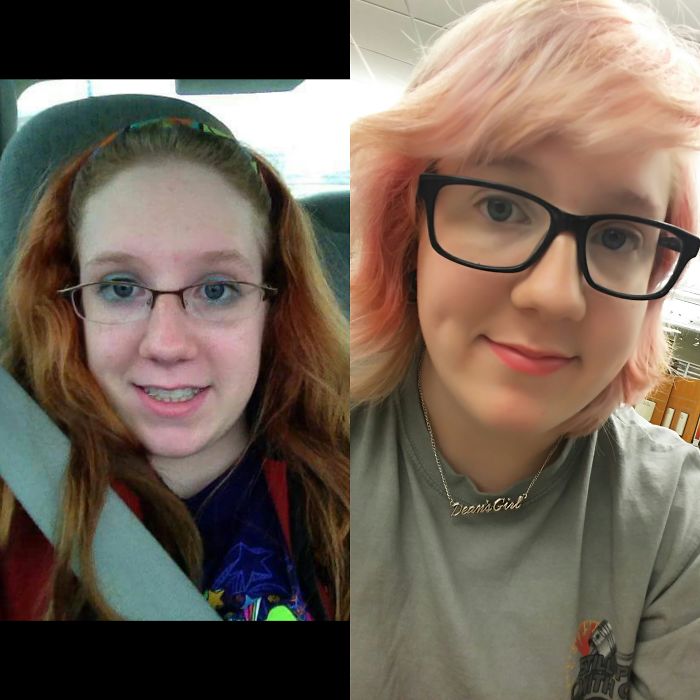 People Share Their Incredible “Ugly Duckling” Transformations And It’s Hard To Believe They’re The Same People People Share Their Incredible “Ugly Duckling” Transformations And It’s Hard To Believe They’re The Same People