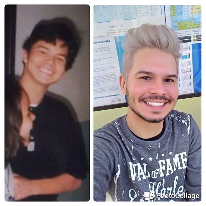 People Share Their Incredible “Ugly Duckling” Transformations And It’s Hard To Believe They’re The Same People People Share Their Incredible “Ugly Duckling” Transformations And It’s Hard To Believe They’re The Same People