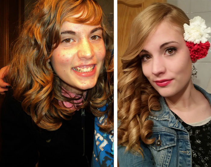 People Share Their Incredible “Ugly Duckling” Transformations And It’s Hard To Believe They’re The Same People People Share Their Incredible “Ugly Duckling” Transformations And It’s Hard To Believe They’re The Same People