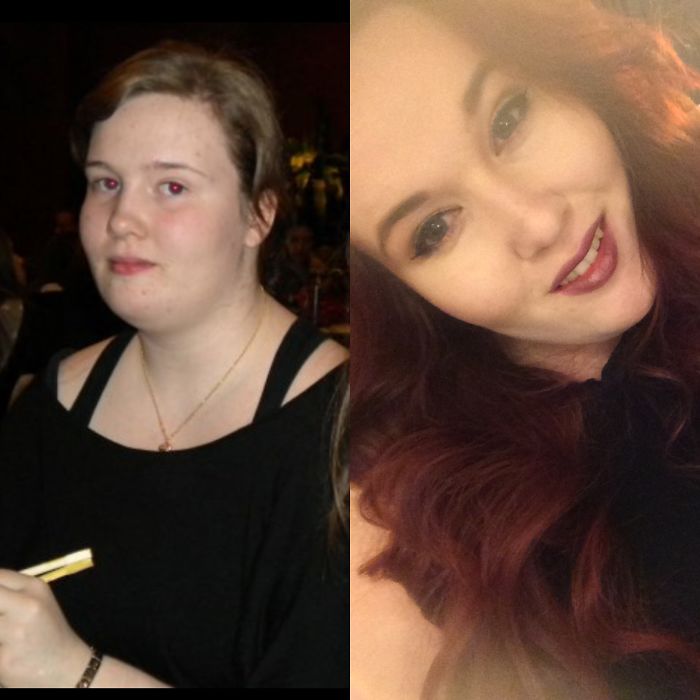 People Share Their Incredible “Ugly Duckling” Transformations And It’s Hard To Believe They’re The Same People People Share Their Incredible “Ugly Duckling” Transformations And It’s Hard To Believe They’re The Same People