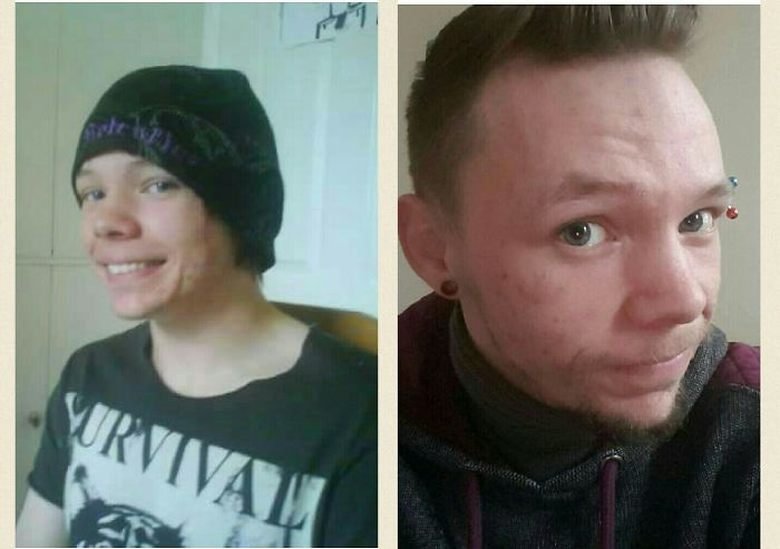 People Share Their Incredible “Ugly Duckling” Transformations And It’s Hard To Believe They’re The Same People People Share Their Incredible “Ugly Duckling” Transformations And It’s Hard To Believe They’re The Same People