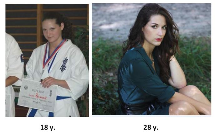 People Share Their Incredible “Ugly Duckling” Transformations And It’s Hard To Believe They’re The Same People People Share Their Incredible “Ugly Duckling” Transformations And It’s Hard To Believe They’re The Same People