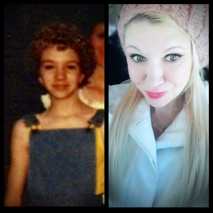 People Share Their Incredible “Ugly Duckling” Transformations And It’s Hard To Believe They’re The Same People People Share Their Incredible “Ugly Duckling” Transformations And It’s Hard To Believe They’re The Same People