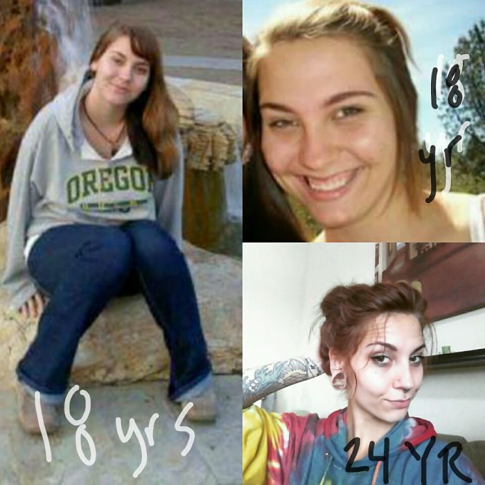 People Share Their Incredible “Ugly Duckling” Transformations And It’s Hard To Believe They’re The Same People People Share Their Incredible “Ugly Duckling” Transformations And It’s Hard To Believe They’re The Same People