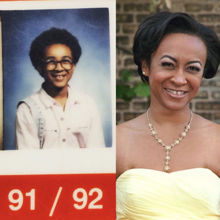 People Share Their Incredible “Ugly Duckling” Transformations And It’s Hard To Believe They’re The Same People People Share Their Incredible “Ugly Duckling” Transformations And It’s Hard To Believe They’re The Same People