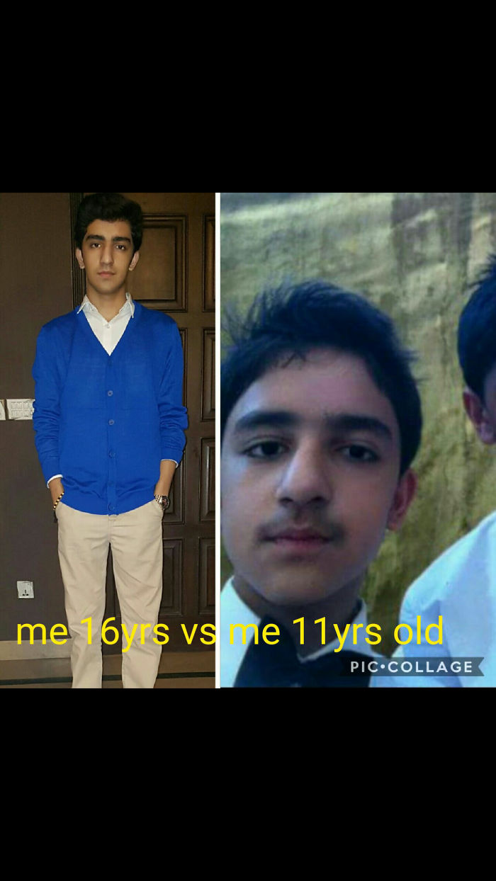 People Share Their Incredible “Ugly Duckling” Transformations And It’s Hard To Believe They’re The Same People People Share Their Incredible “Ugly Duckling” Transformations And It’s Hard To Believe They’re The Same People