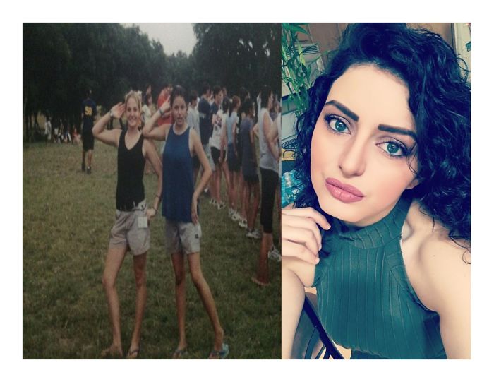 People Share Their Incredible “Ugly Duckling” Transformations And It’s Hard To Believe They’re The Same People People Share Their Incredible “Ugly Duckling” Transformations And It’s Hard To Believe They’re The Same People