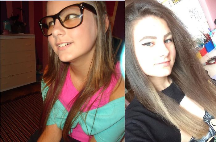 People Share Their Incredible “Ugly Duckling” Transformations And It’s Hard To Believe They’re The Same People People Share Their Incredible “Ugly Duckling” Transformations And It’s Hard To Believe They’re The Same People