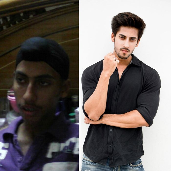 People Share Their Incredible “Ugly Duckling” Transformations And It’s Hard To Believe They’re The Same People People Share Their Incredible “Ugly Duckling” Transformations And It’s Hard To Believe They’re The Same People