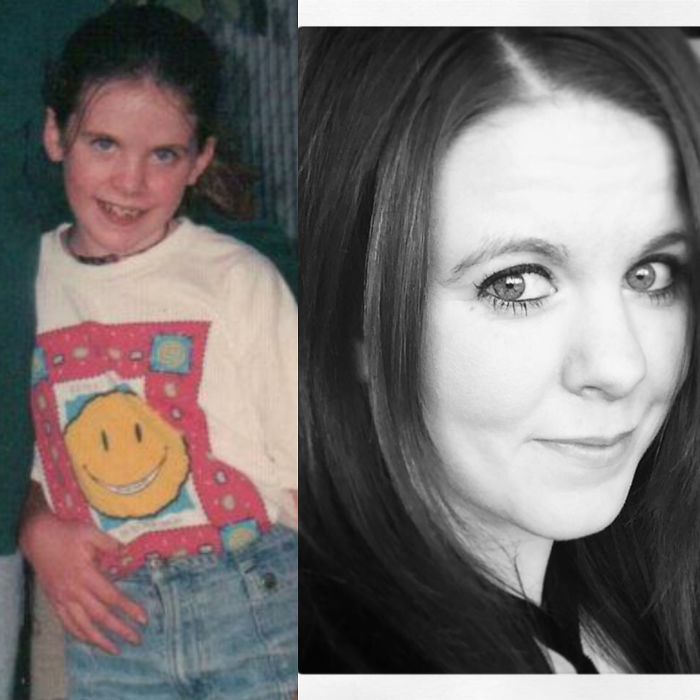 People Share Their Incredible “Ugly Duckling” Transformations And It’s Hard To Believe They’re The Same People People Share Their Incredible “Ugly Duckling” Transformations And It’s Hard To Believe They’re The Same People