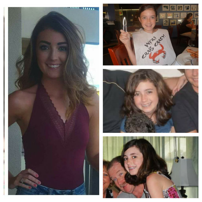 People Share Their Incredible “Ugly Duckling” Transformations And It’s Hard To Believe They’re The Same People People Share Their Incredible “Ugly Duckling” Transformations And It’s Hard To Believe They’re The Same People