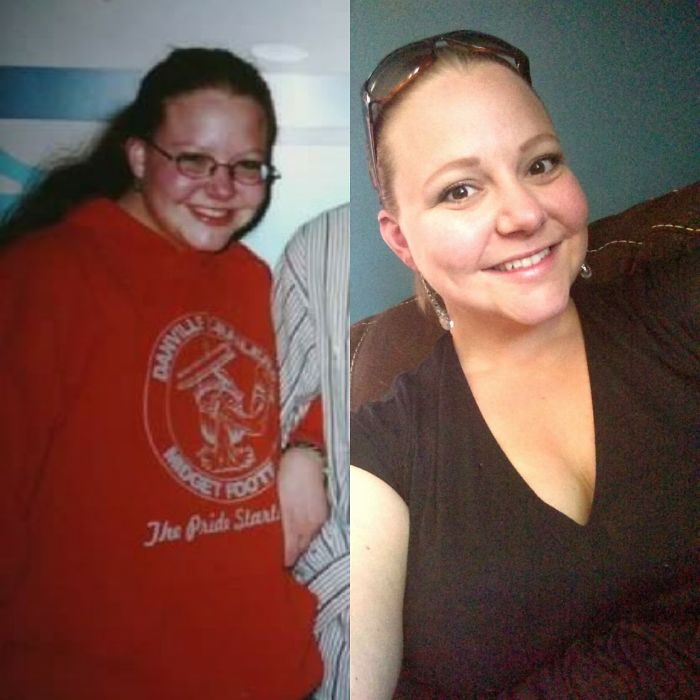 People Share Their Incredible “Ugly Duckling” Transformations And It’s Hard To Believe They’re The Same People People Share Their Incredible “Ugly Duckling” Transformations And It’s Hard To Believe They’re The Same People