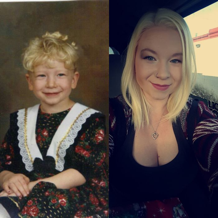 People Share Their Incredible “Ugly Duckling” Transformations And It’s Hard To Believe They’re The Same People People Share Their Incredible “Ugly Duckling” Transformations And It’s Hard To Believe They’re The Same People