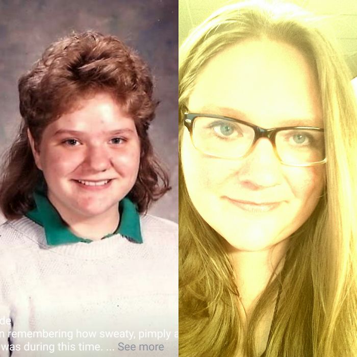People Share Their Incredible “Ugly Duckling” Transformations And It’s Hard To Believe They’re The Same People People Share Their Incredible “Ugly Duckling” Transformations And It’s Hard To Believe They’re The Same People