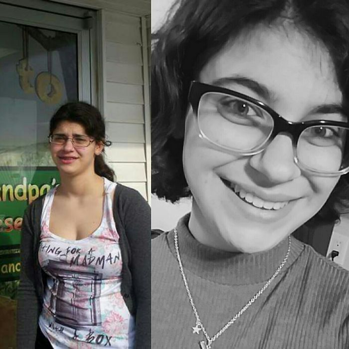 People Share Their Incredible “Ugly Duckling” Transformations And It’s Hard To Believe They’re The Same People People Share Their Incredible “Ugly Duckling” Transformations And It’s Hard To Believe They’re The Same People