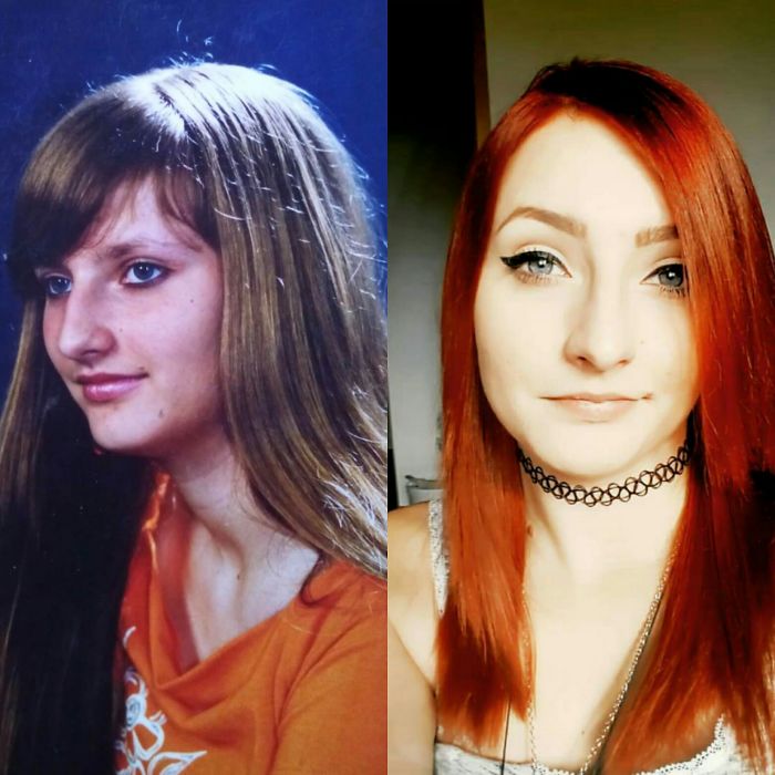 People Share Their Incredible “Ugly Duckling” Transformations And It’s Hard To Believe They’re The Same People People Share Their Incredible “Ugly Duckling” Transformations And It’s Hard To Believe They’re The Same People