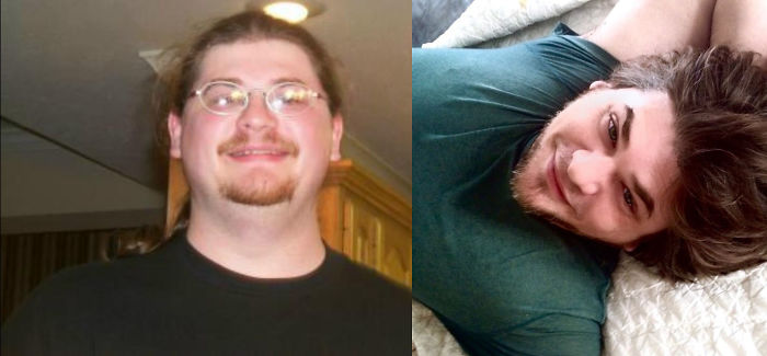 People Share Their Incredible “Ugly Duckling” Transformations And It’s Hard To Believe They’re The Same People People Share Their Incredible “Ugly Duckling” Transformations And It’s Hard To Believe They’re The Same People