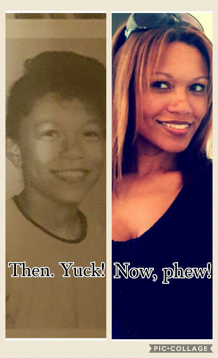 People Share Their Incredible “Ugly Duckling” Transformations And It’s Hard To Believe They’re The Same People People Share Their Incredible “Ugly Duckling” Transformations And It’s Hard To Believe They’re The Same People