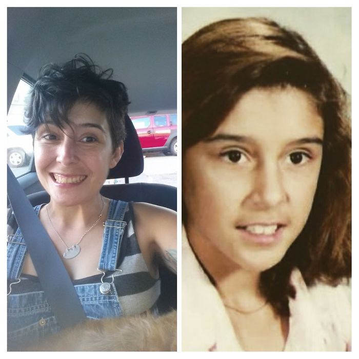 People Share Their Incredible “Ugly Duckling” Transformations And It’s Hard To Believe They’re The Same People People Share Their Incredible “Ugly Duckling” Transformations And It’s Hard To Believe They’re The Same People